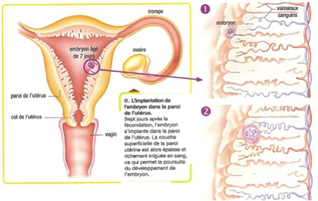 Schéma de la nidation de l'embryon dans l'utérus