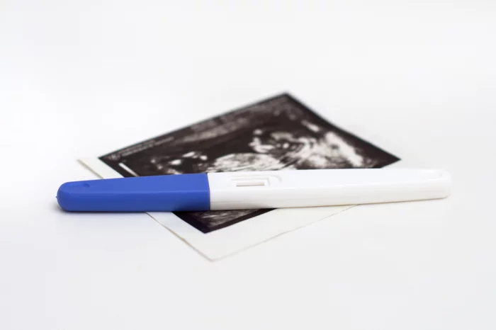 Test de grossesse posé sur une échographie