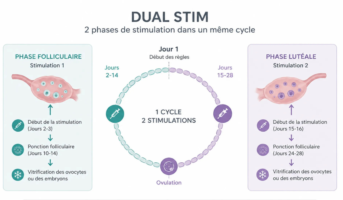 Illustration de la technique Dual Stim